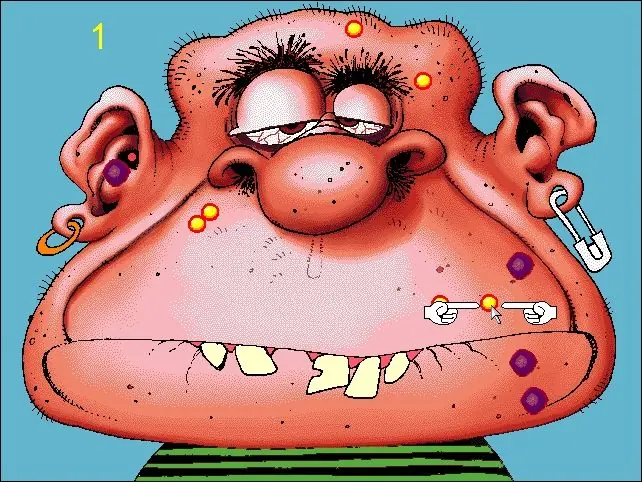 Acne Attack Game Cover